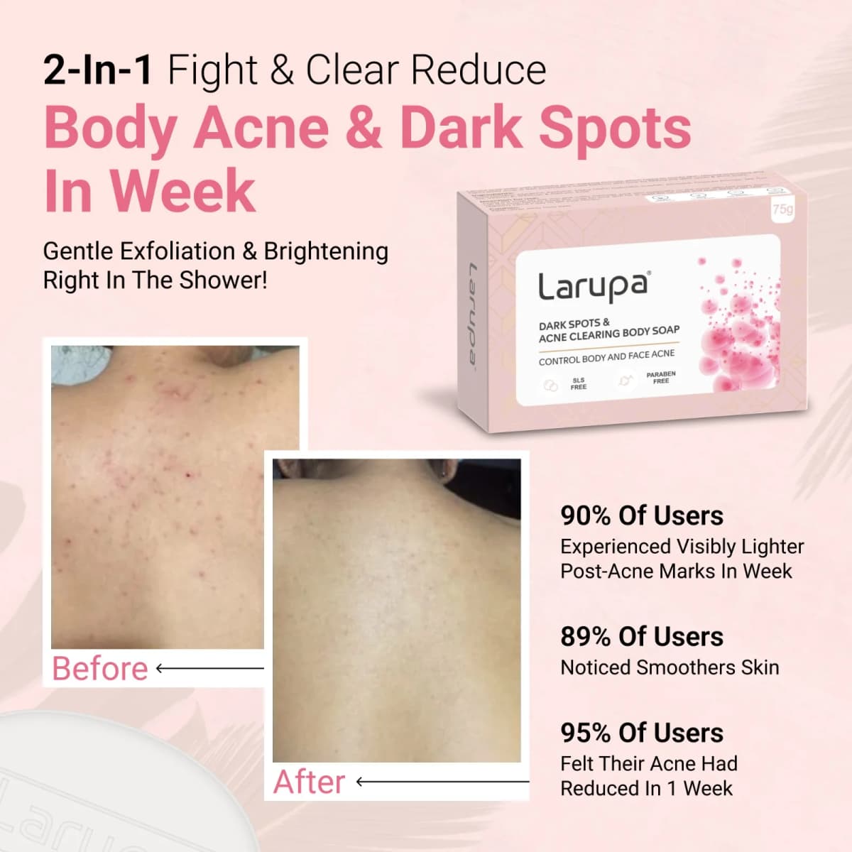 Larupa Dark Spots & Acne Clearing Body Soap - before-after
